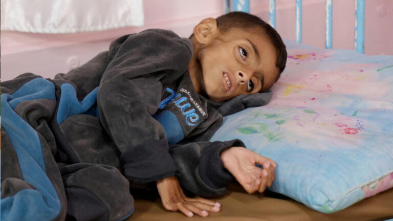 إسرائيل تمنع التمر والبطاطا من دخول غزة..كيف يؤثر ذلك على صحة الغزيين؟