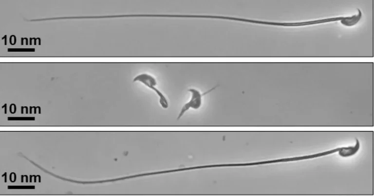 اكتشاف تركيب الحيوانات المنوية يمهد لتشخيص أسباب العقم