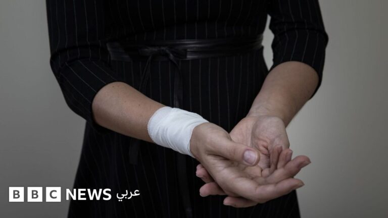 اليوم العالمي للقضاء على العنف ضد المرأة: كيف يمكن الحد من العنف في الدول العربية؟